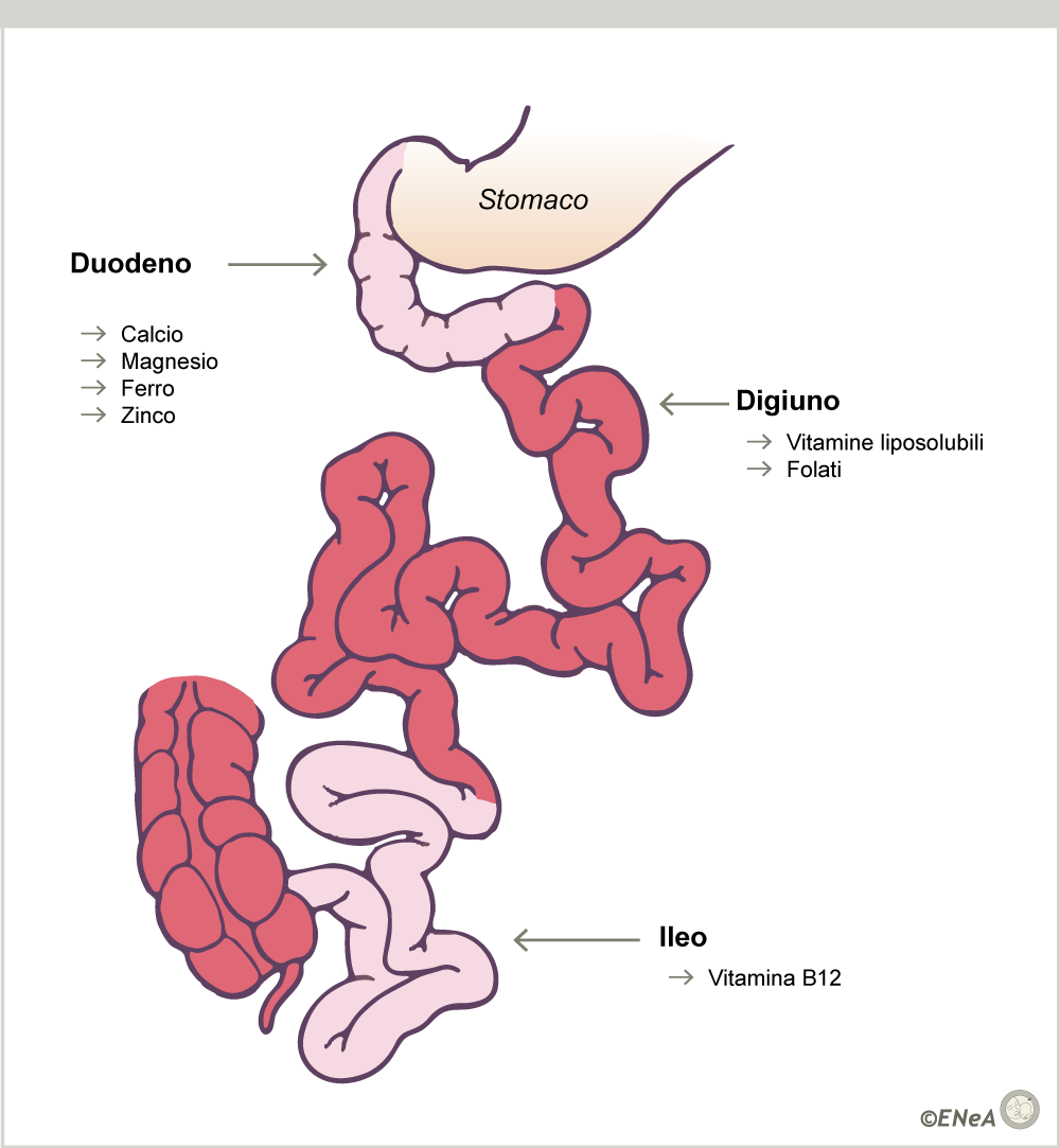 Gestione Della Malattia Celiaca: Lezione 3: Cosa Significano Celiachia ...