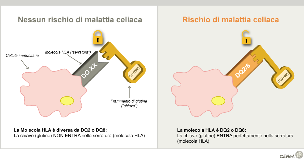 Gestione Della Malattia Celiaca: Lezione 2: Perché, Anche Se Tutti ...